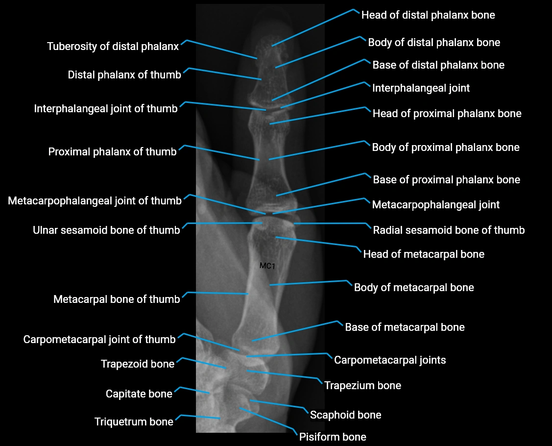 x ray thumb AP anatomy labelled.webp